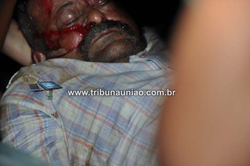 Ancião morre atropelado por motocicleta na Al-205 em União dos Palmares