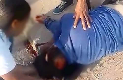 Até quando “Ladeira da Morte?” – Vítima de acidente sofre ferimentos graves após perder o controle de motocicleta