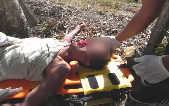 Acidente com moto deixa vitíma fatal em União dos Palmares
