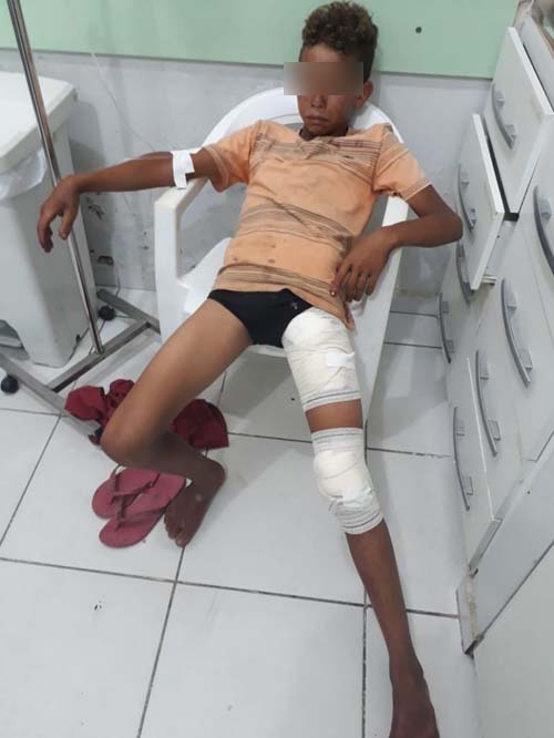 Menor é alvejado com tiro de espingarda soca tempero