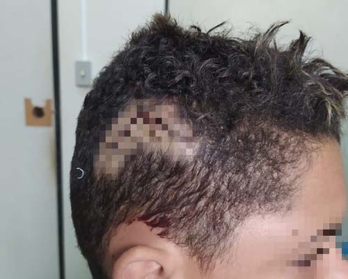 Adolescente é agredido com barra de ferro pelo pai após assumir orientação sexual, em Maceió