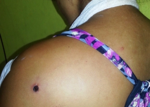 Adolescente de 17 anos é atingida com cinco tiros enquanto amamentava criança em Inhapi 