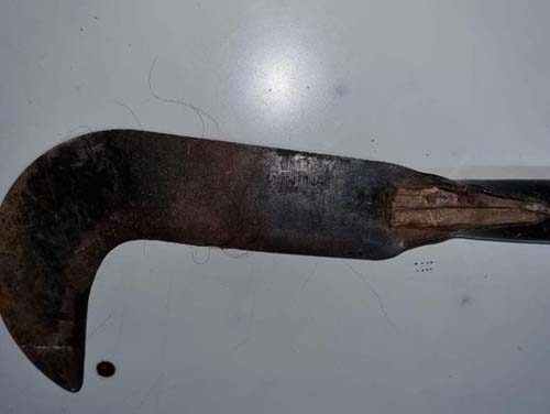 Jovem agredida a golpes foice pelo marido em Palmeira, tem melhora, diz HEA