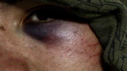 CCJ aprova tipificação do crime de espancamento