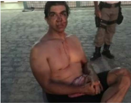 Homem é baleado e agredido com coronhadas durante trilha na parte alta de Maceió