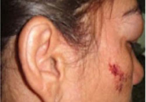 Homem é preso acusado de agredir a esposa com esporas para cavalo 