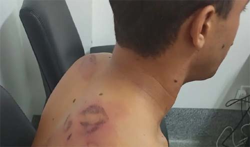 OAB/AL vai acompanhar caso do casal que denuncia ter sido espancado por PMs