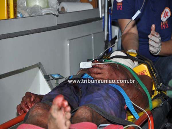 Após discussão, mulher golpeia cabeça de marido com facão na periferia da cidade