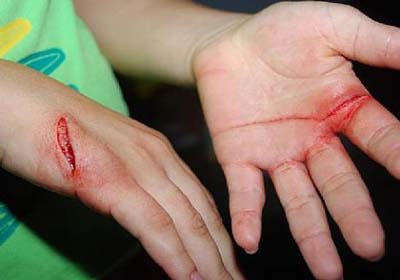 Pai esfaqueia filha ao encontrá-la com namorado dentro de casa