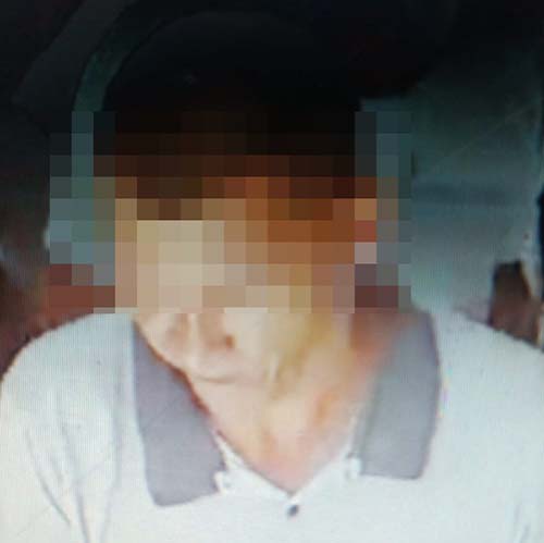 Após fim de relacionamento, homem tenta matar mulher jogando acido em Marechal Deodoro