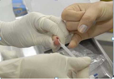 Saúde quer testar hepatite, sífilis e HIV em 500 mil pessoas em dez dias