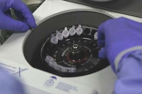 Sobe para 34 o número de casos investigados para Covid-19 em Alagoas