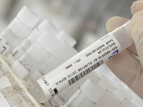 Alagoas registra mais 396 casos de Covid e nove mortes