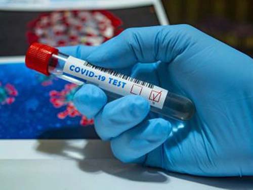 Boletim: jovem de 16 anos sem comorbidades está entre as vítimas fatais da Covid-19 em Alagoas