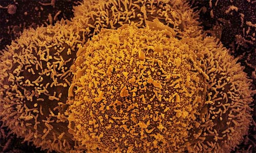 Alagoas tem 17 novos casos de Covid 19 e segue sem registrar mortes