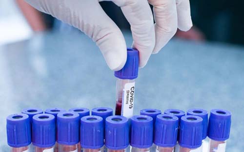 Alagoas chega ao 5º dia seguido sem registro de mortes por Covid-19; 40 casos foram confirmados