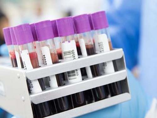 Com 22 novos registros, Alagoas passa das 3.500 mortes por Covid-19