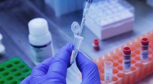 Alagoas registra óbito por Covid-19 após mês sem mortes