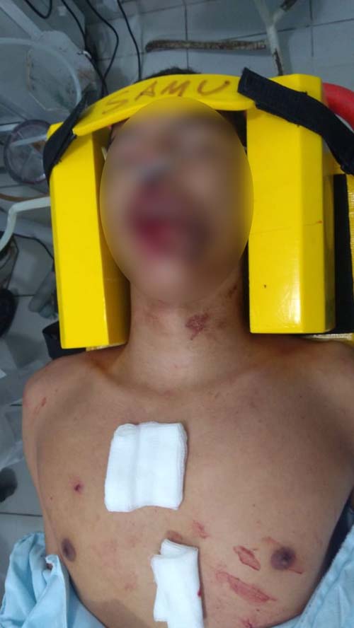 Homem é atacado a bala no antigo posto BR na periferia de União dos Palmares