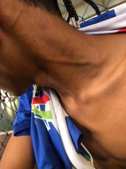 Servidores são afastados suspeitos de agredir alunos em Campo Alegre