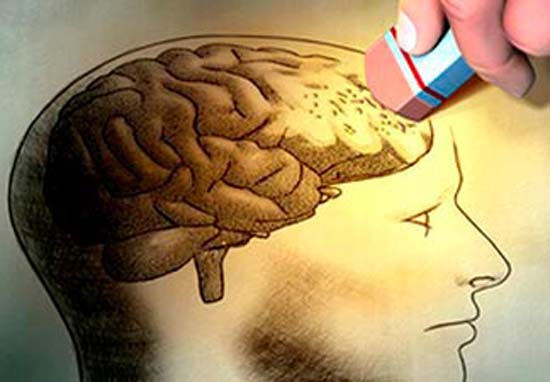 Doença confundida com Alzheimer e Parkinson pode ser curada com cirurgia