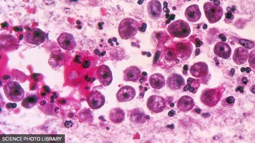 Ameba ‘comedora de cérebros’: o que levou autoridades do Texas a emitirem alerta