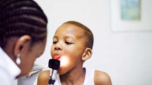 Amigdalite recorrente pode levar à cirurgia