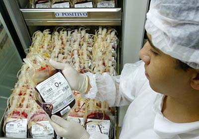 Detecção do vírus HIV em teste nacional é falha