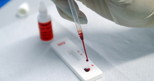 Vídeo educativo informa à população sobre sífilis