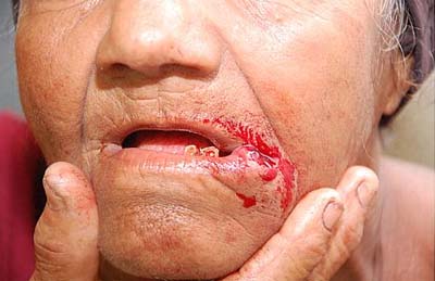 Menor invade residência rouba e esfaqueia casal de idosos em Marechal Deodoro