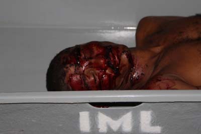 Sem terra é executado com tiro na cabeça em Rio Largo