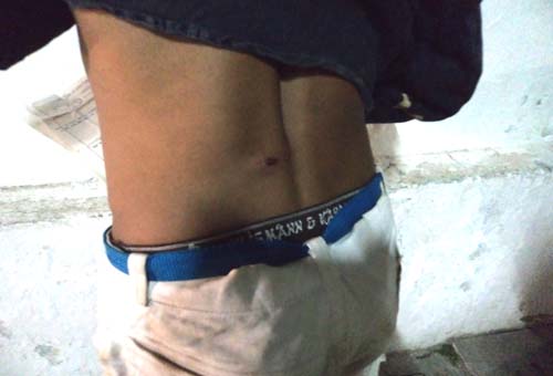 Tiroteio na periferia de União deixa 3 feridos a bala: o mais grave, uma menor de 12 anos de idade