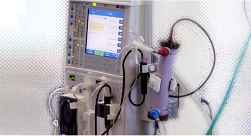 Crescimento no número de casos de diálise e transplante no País demanda atenção