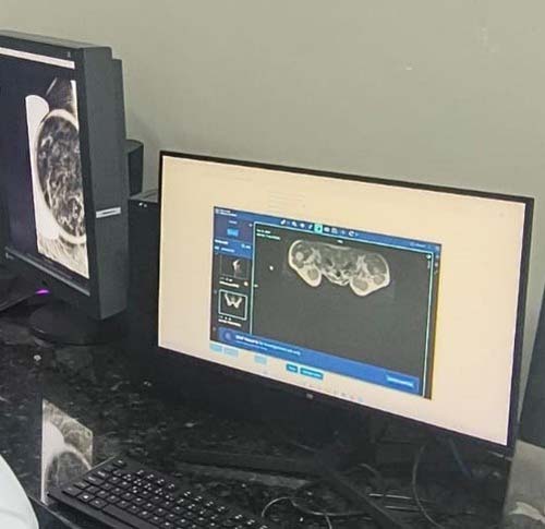 Hospital Universitário de Alagoas adota telerradiologia para modernizar exames e agilizar diagnósticos