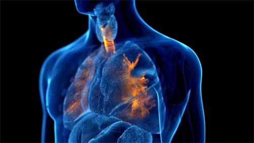 Asma: 10 coisas que você precisa saber para conviver melhor com a doença