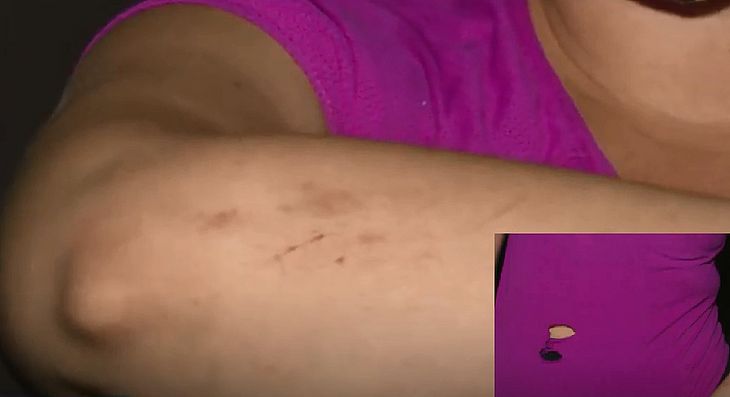 Mulher é agredida em assalto na orla de Cruz das Almas: 'Não faz isso, moço, por favor'
