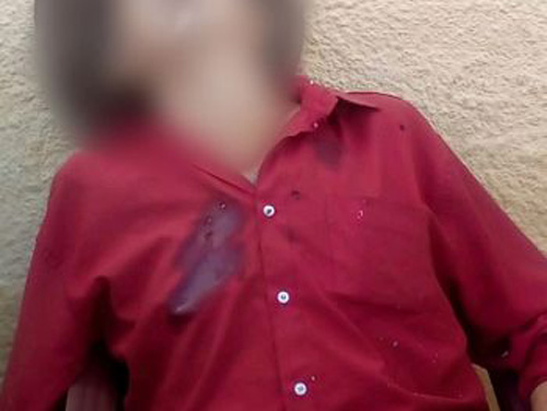 Idoso é morto a tiros enquanto tomava café da manhã em barraca no centro de Senador Rui Palmeira