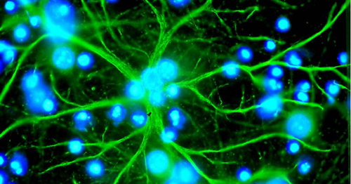 Células do sistema nervoso são a chave para entender o autismo