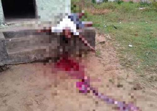 Atentado à bala deixa um morto e outro ferido; imagem forte