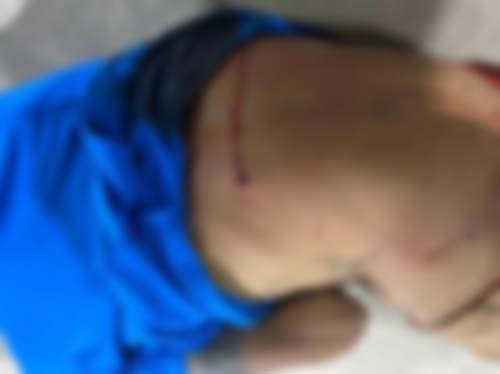 Jovem de 19 anos é alvejado a tiros na cidade de Lagoa da Canoa