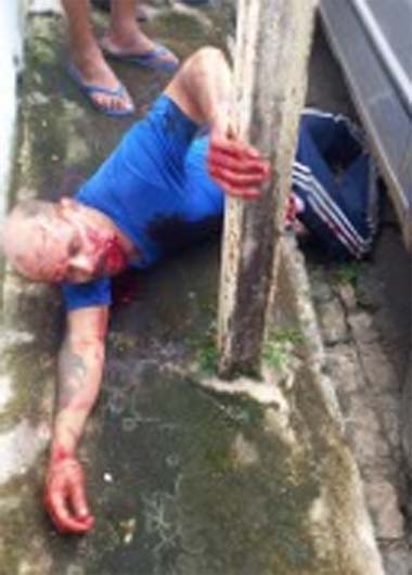 Homem é atingido por dois disparos na feira livre de União dos Palmares