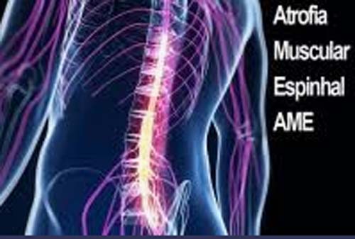Medicamento para Atrofia Muscular Espinhal (AME) não terá imposto de importação