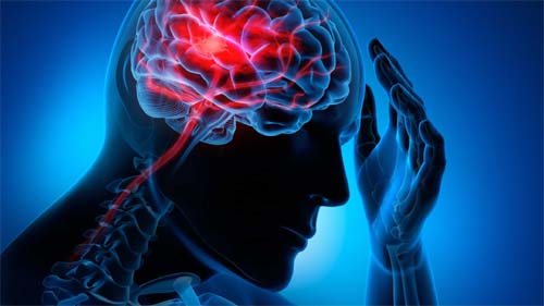 Descubra a diferença entre infarto, AVC e angina