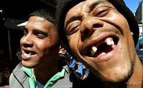 15 milhões de brasileiros vivem sem dente na boca
