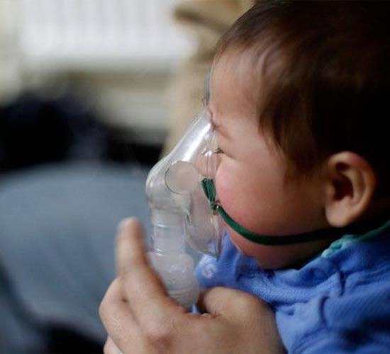 Principal vírus causador de bronquiolite em bebês pode ser evitado