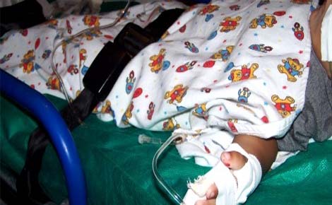 Padrasto agride bebê de 1 ano com várias mordidas pelo corpo em Bezerros