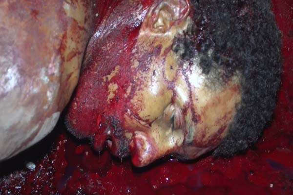 Homem é morto com mais de 10 facadas enquanto assistia culto regilioso