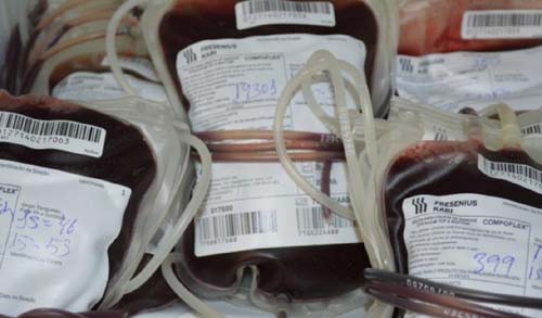 Cirurgias eletivas podem ser canceladas devido a falta de doação de sangue diz Hemnoal diz HEMOAL