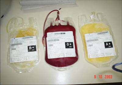 Hemoal necessita urgente de sangue A Negativo e B Positivo e Negativo