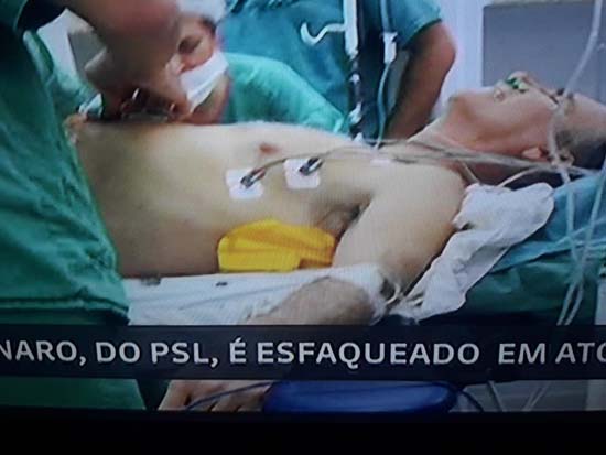 Primeiras 48h serão decisivas para Bolsonaro; saiba os riscos